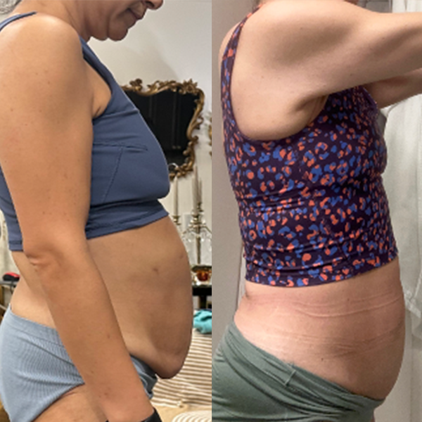 Desiree transformation