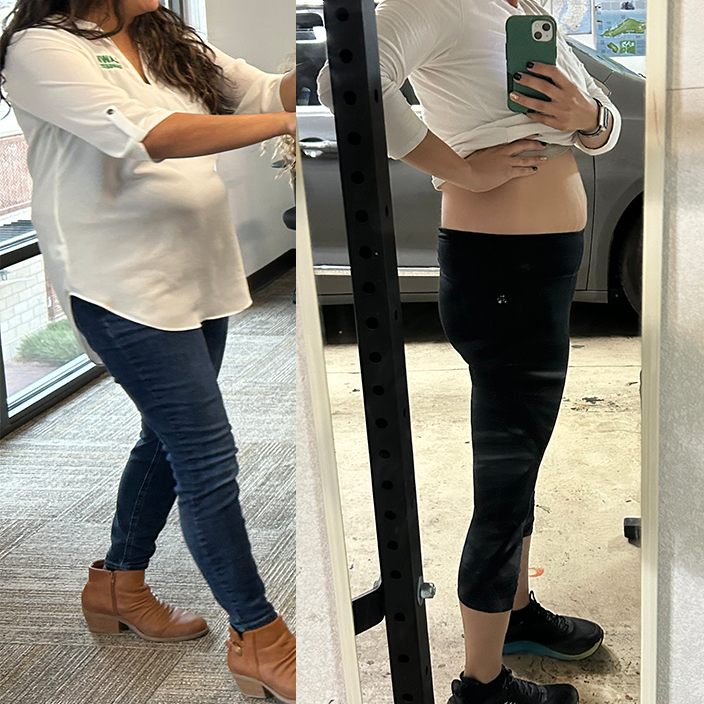 Renee transformation